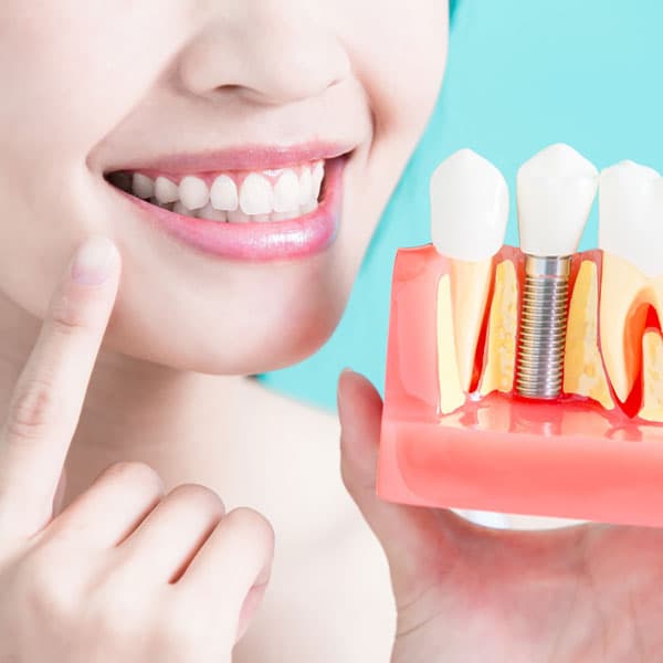 Implantología dental en Santiago de Compostela