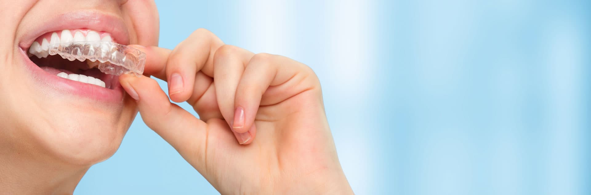 Solicite su tratamiento dental en Santiago y Zas